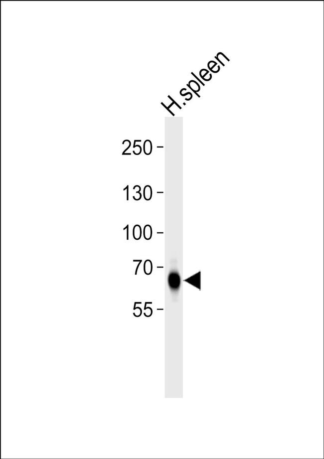 MX1 Antibody in Western Blot (WB)