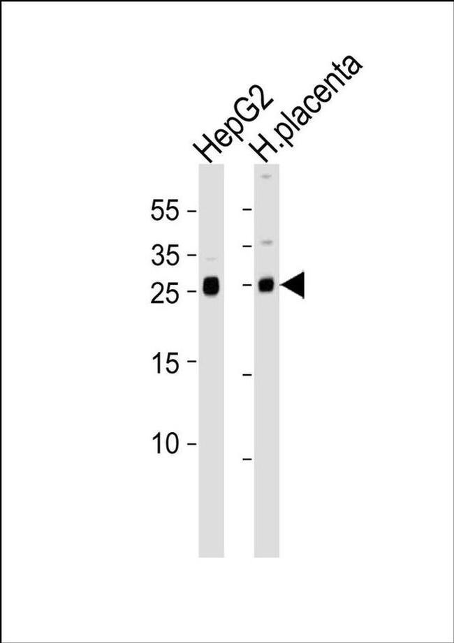 FLRG Antibody in Western Blot (WB)