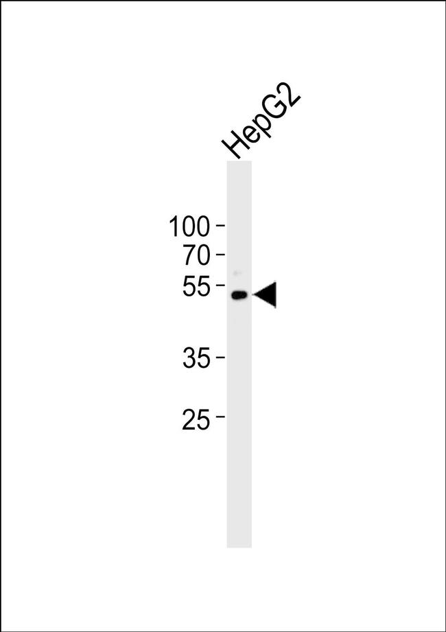 DHCR7 Antibody in Western Blot (WB)