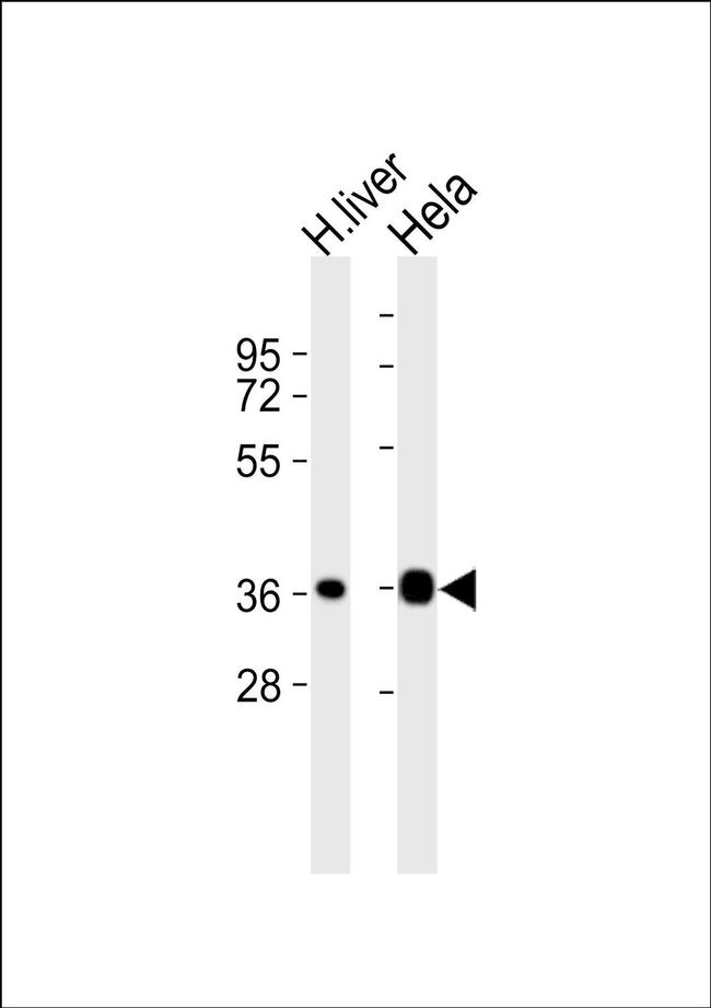 Apolipoprotein F Antibody in Western Blot (WB)