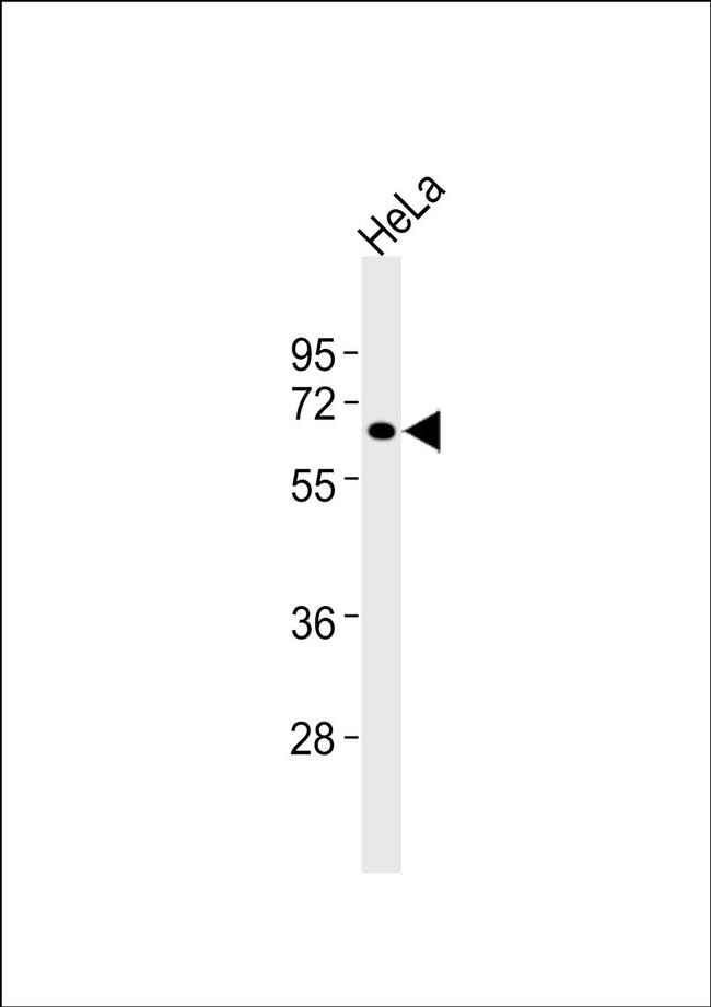 C1r Antibody in Western Blot (WB)