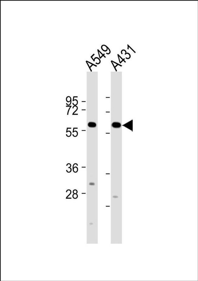 CYP2J2 Antibody in Western Blot (WB)