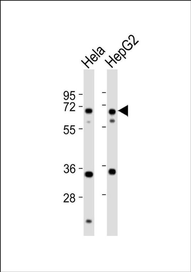 NEIL3 Antibody in Western Blot (WB)