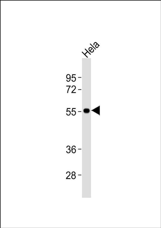 ENT1 Antibody in Western Blot (WB)