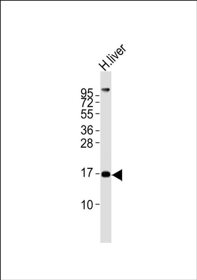 MGST2 Antibody in Western Blot (WB)