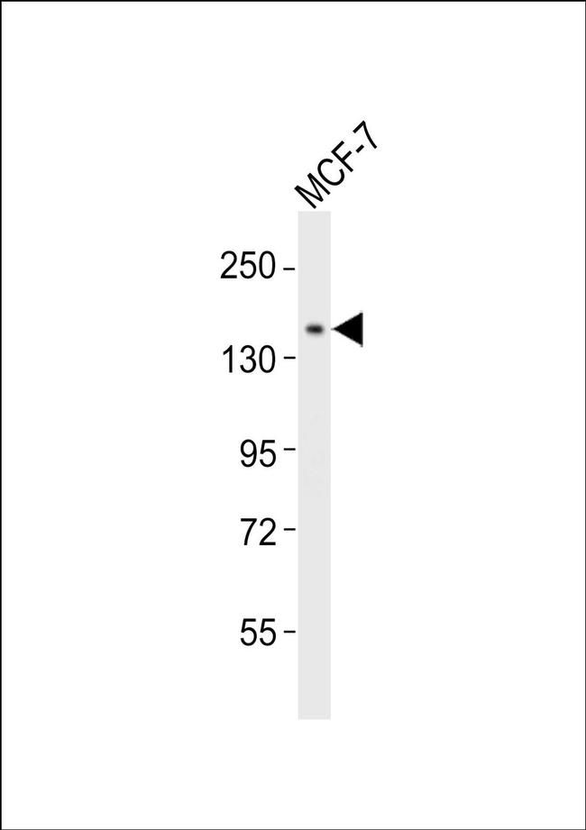 NACAD Antibody in Western Blot (WB)