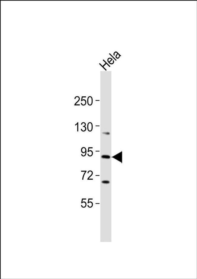 RASA4 Antibody in Western Blot (WB)