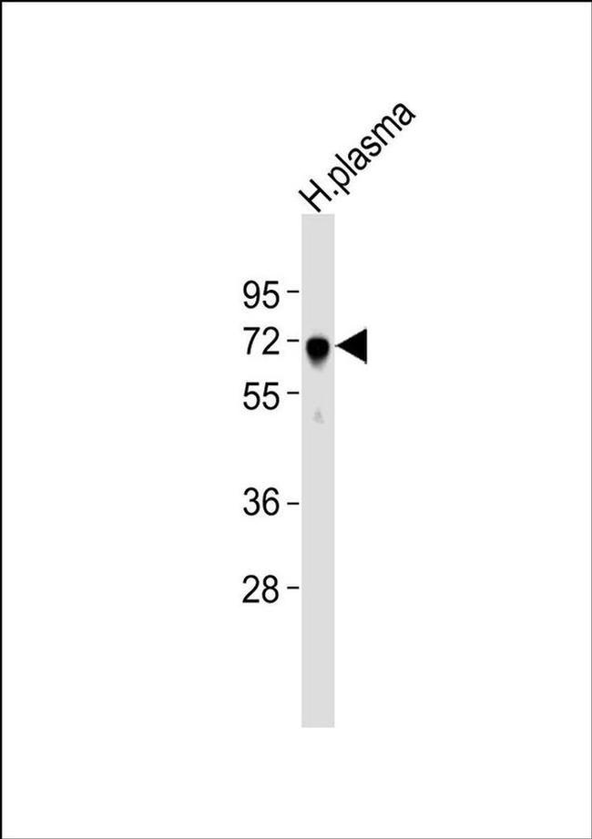 ALS Antibody in Western Blot (WB)