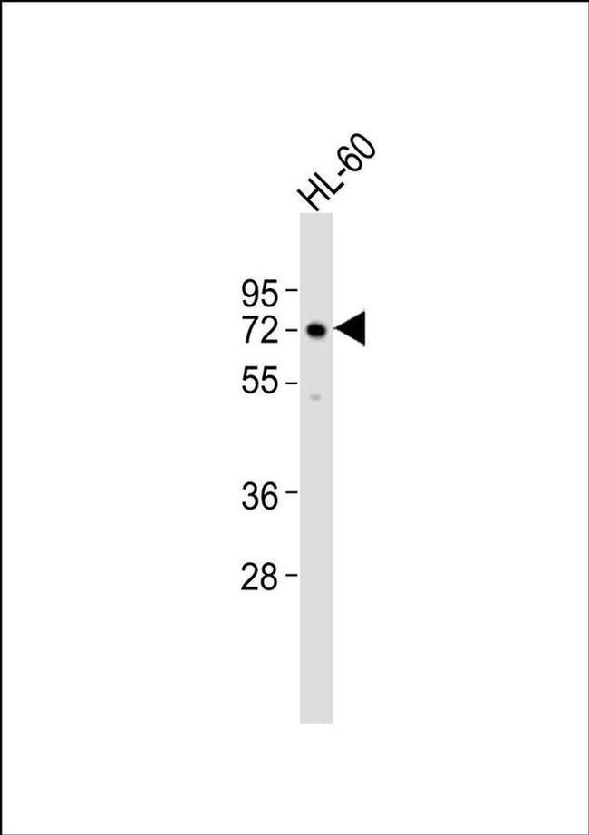 ASM Antibody in Western Blot (WB)