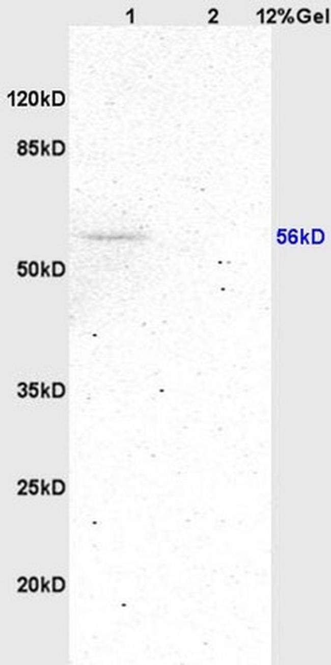 CYP17A1 Antibody in Western Blot (WB)
