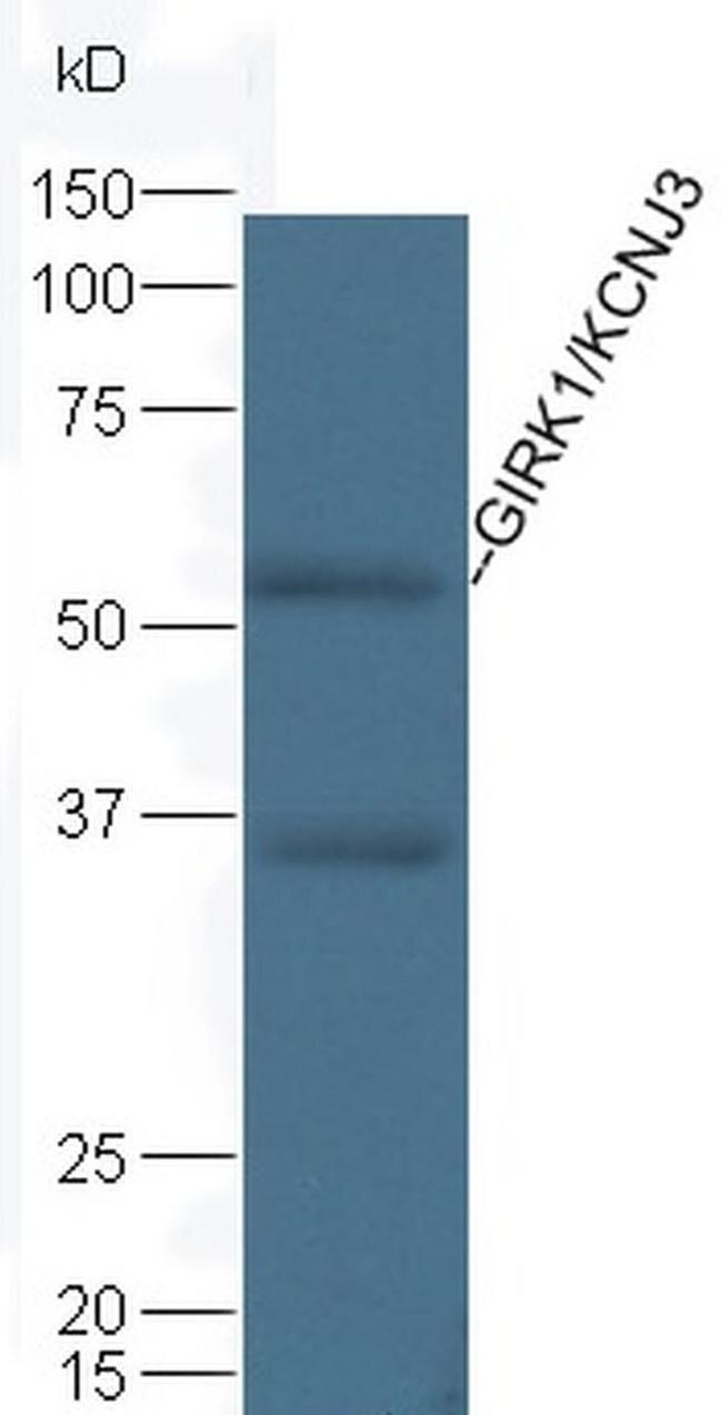 Kir3.1 (KCNJ3) Antibody in Western Blot (WB)