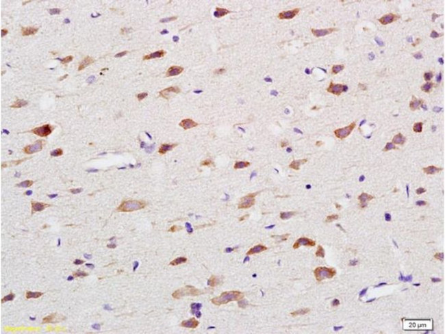 NOX4 Antibody in Immunohistochemistry (Paraffin) (IHC (P))