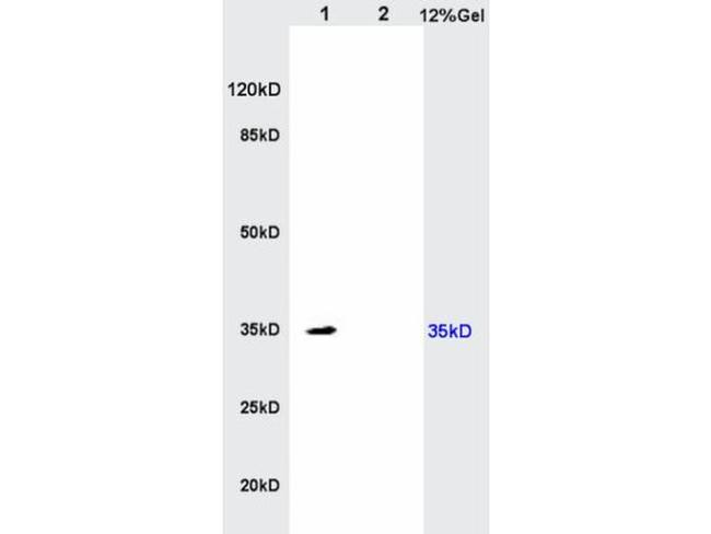 IL17RB Antibody in Western Blot (WB)