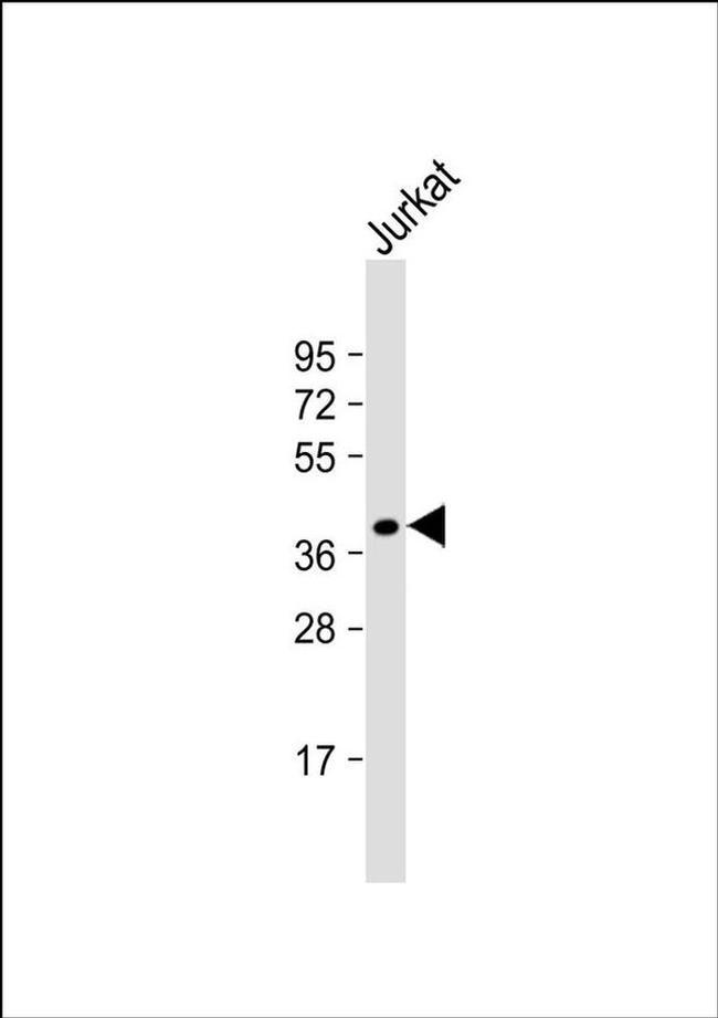 FAM84B Antibody in Western Blot (WB)