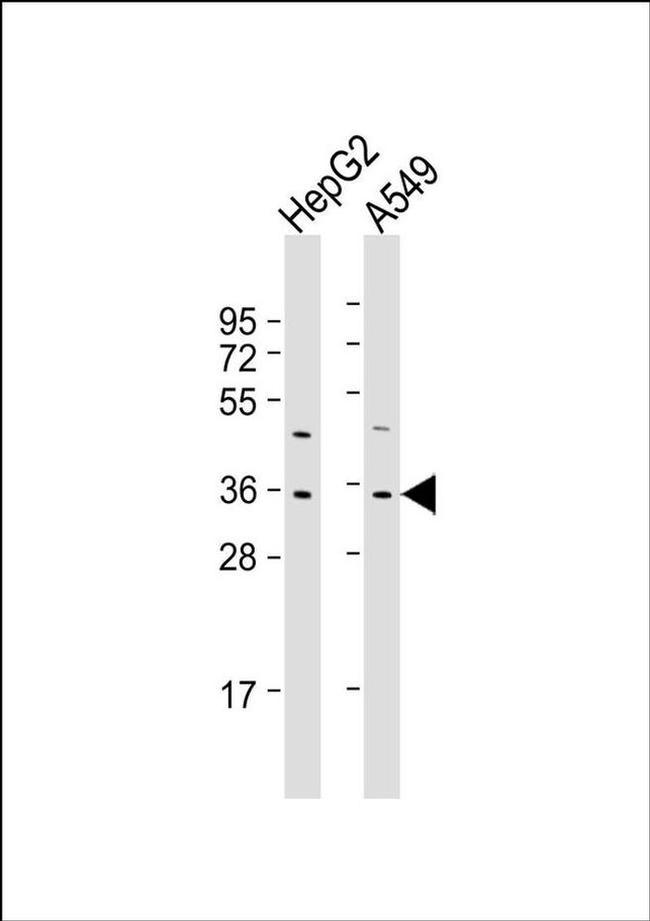FOXE3 Antibody in Western Blot (WB)