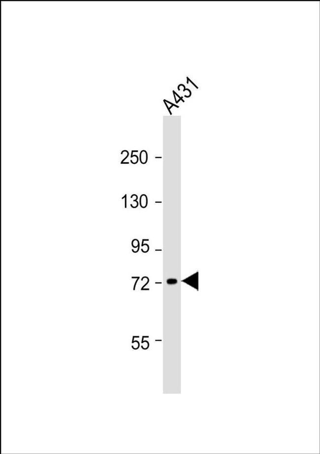 GBP4 Antibody in Western Blot (WB)