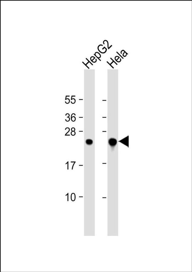 MRRF Antibody in Western Blot (WB)