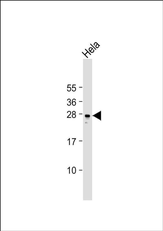 RAB34 Antibody in Western Blot (WB)