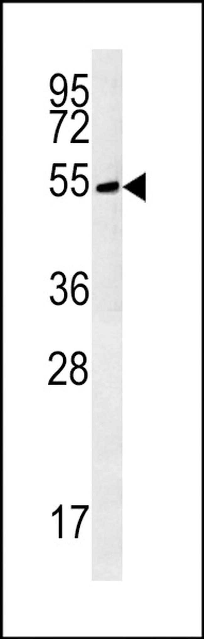 TRMT11 Antibody in Western Blot (WB)