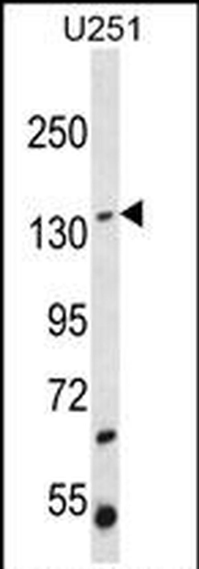 ST5 Antibody in Western Blot (WB)