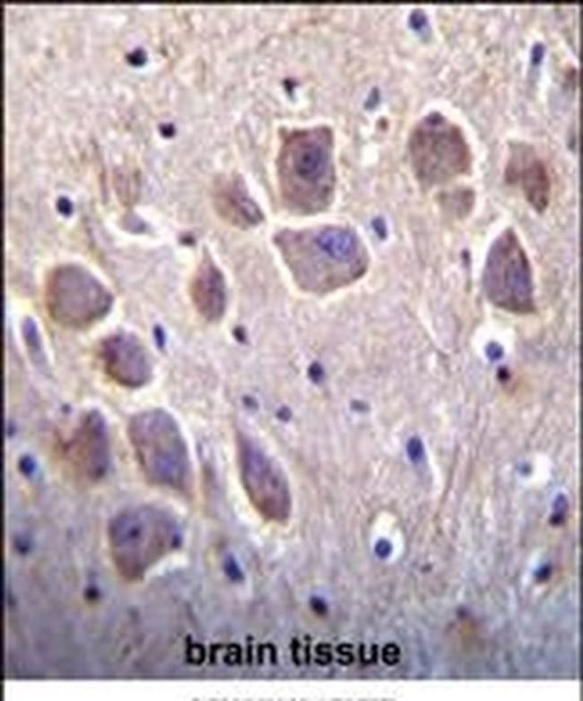 RCAN2 Antibody in Immunohistochemistry (IHC)