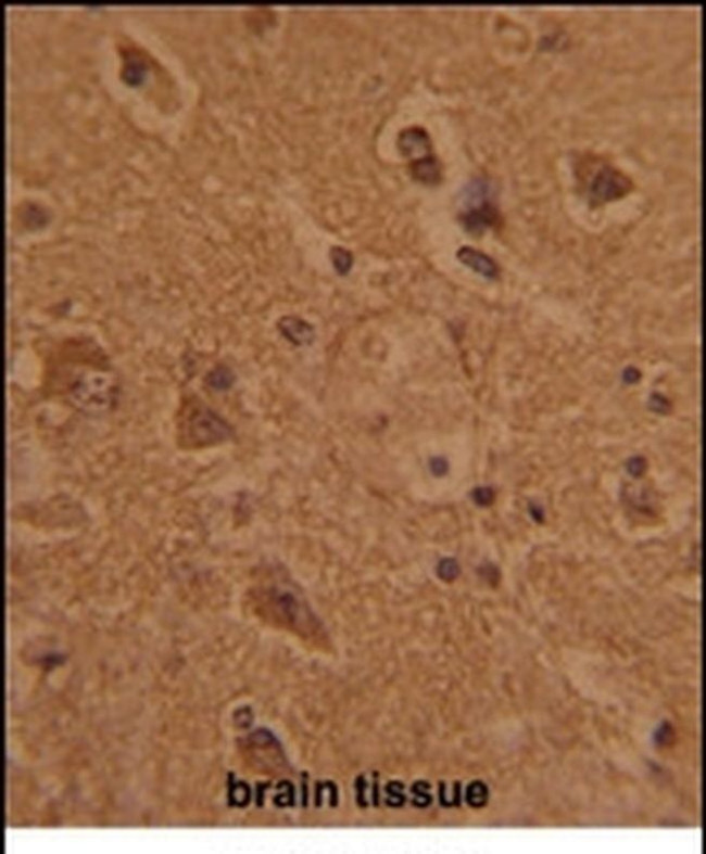FCP1 Antibody in Immunohistochemistry (IHC)