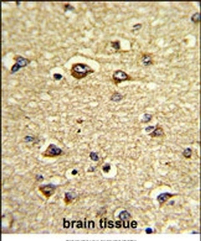 GAS7 Antibody in Immunohistochemistry (IHC)