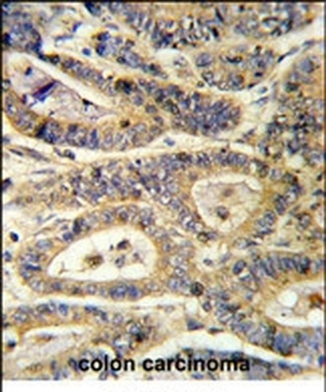 IGFBP6 Antibody in Immunohistochemistry (IHC)