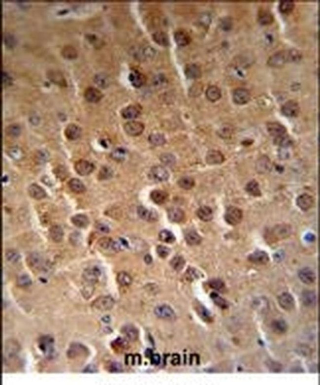 PFTK1 Antibody in Immunohistochemistry (IHC)