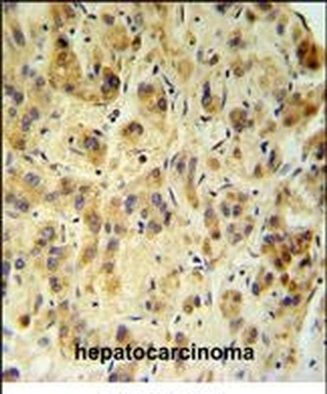 FUCA1 Antibody in Immunohistochemistry (IHC)