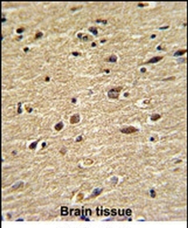 CUEDC2 Antibody in Immunohistochemistry (IHC)