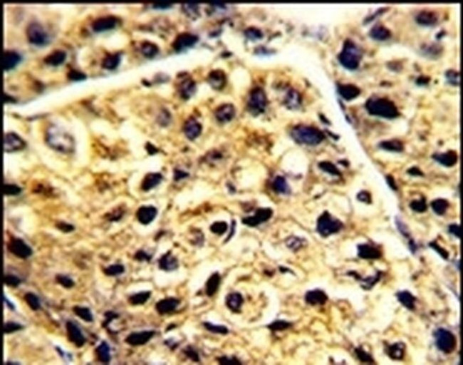 AADAC Antibody in Immunohistochemistry (IHC)