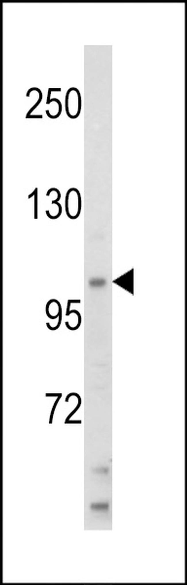 HLTF Antibody in Western Blot (WB)