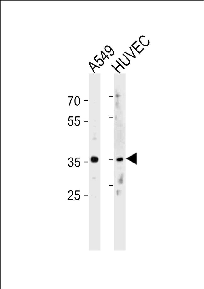 HOXB5 Antibody in Western Blot (WB)