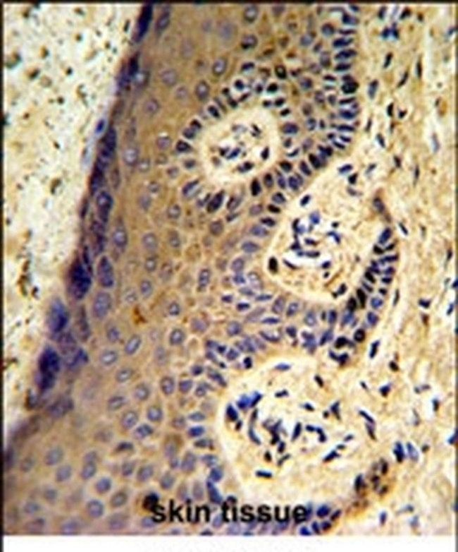 MAFF Antibody in Immunohistochemistry (IHC)