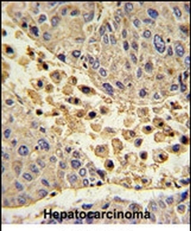 COLEC11 Antibody in Immunohistochemistry (IHC)