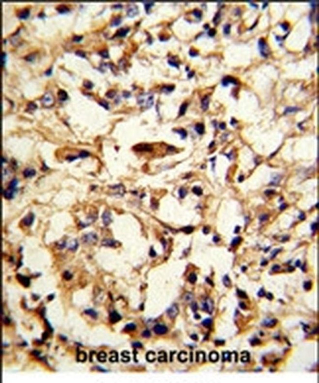 DFNA5 Antibody in Immunohistochemistry (IHC)