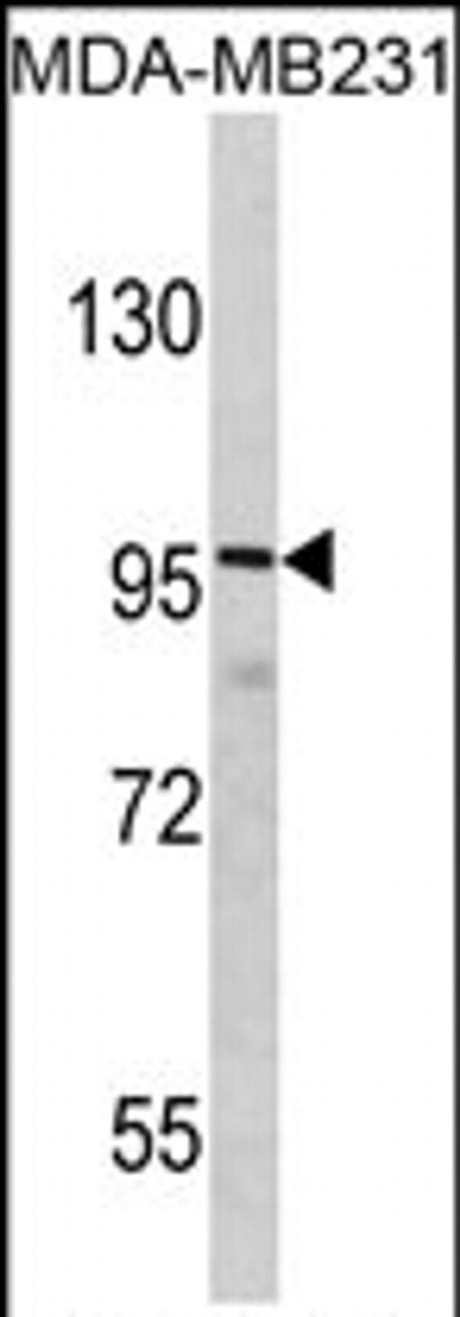 SAPAP1 Antibody in Western Blot (WB)