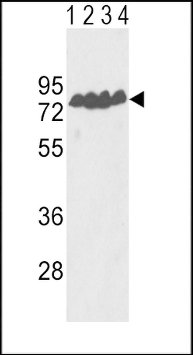 ECE1 Antibody in Western Blot (WB)