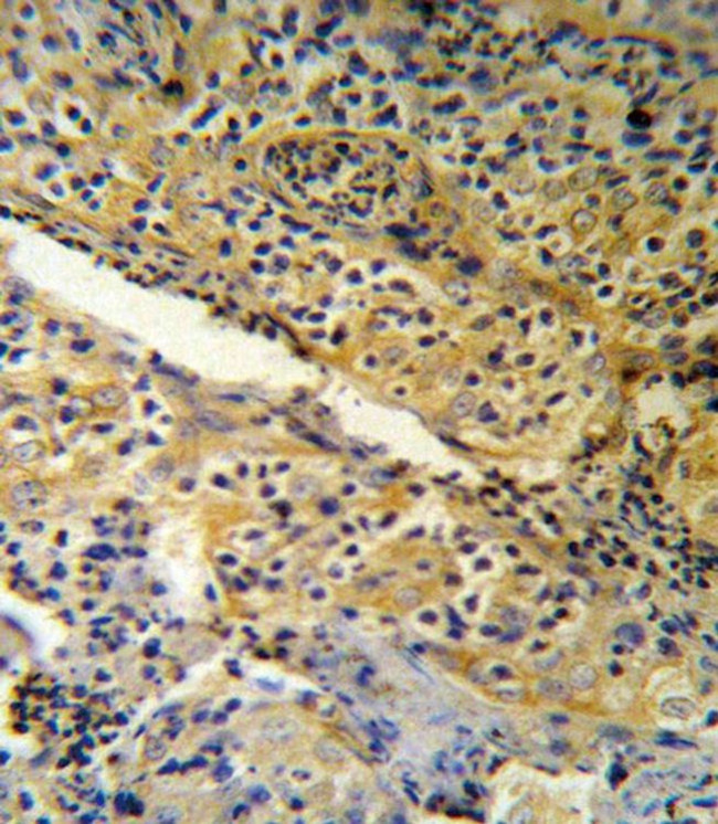 SPINK5 Antibody in Immunohistochemistry (IHC)