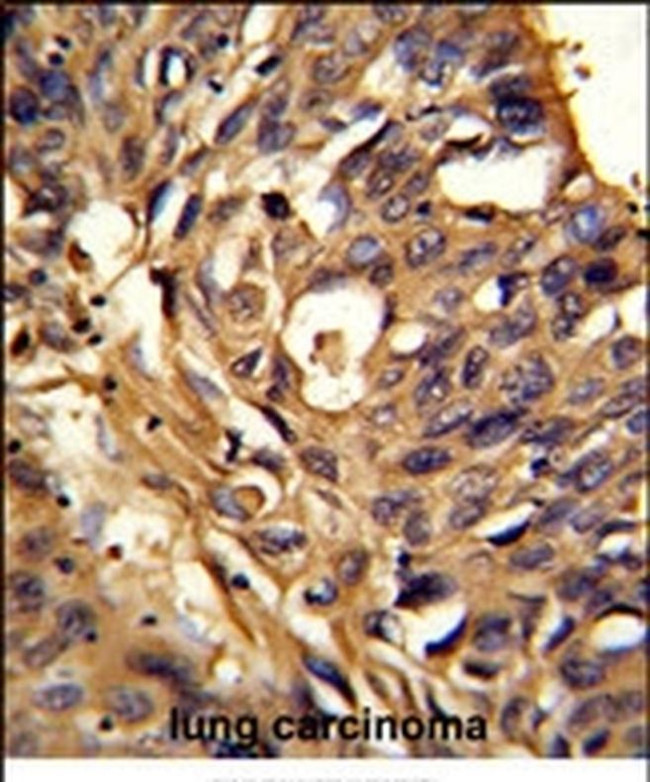 ETFDH Antibody in Immunohistochemistry (IHC)