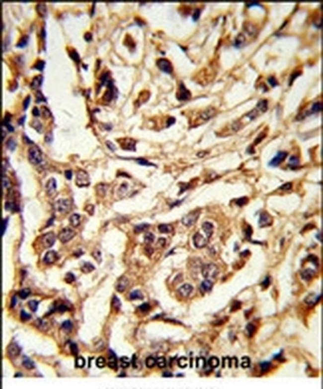 GALT Antibody in Immunohistochemistry (IHC)