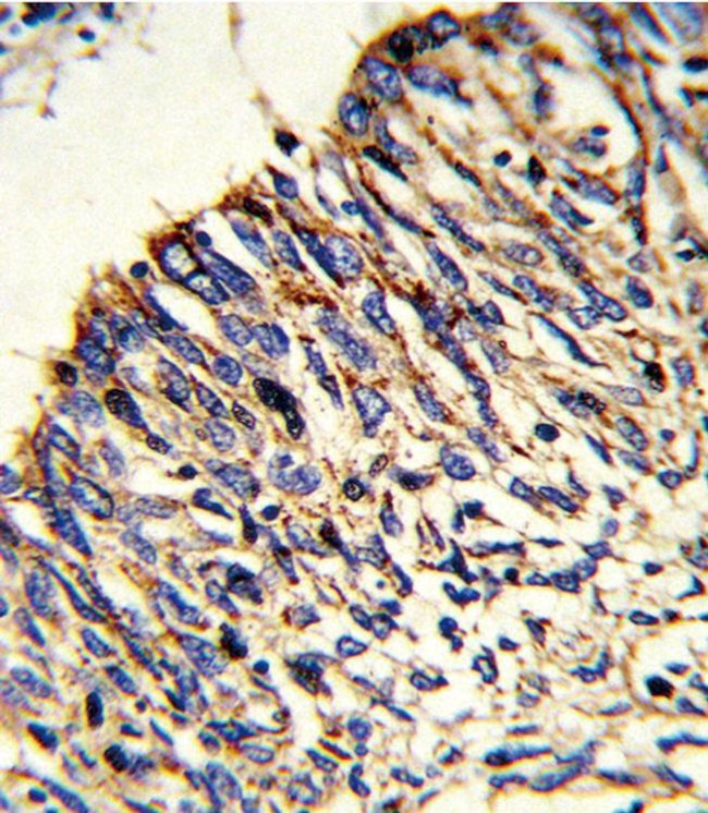 HADHA Antibody in Immunohistochemistry (IHC)