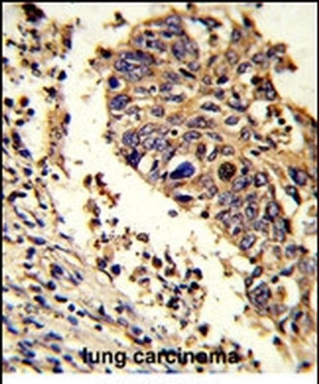LUC7L Antibody in Immunohistochemistry (IHC)