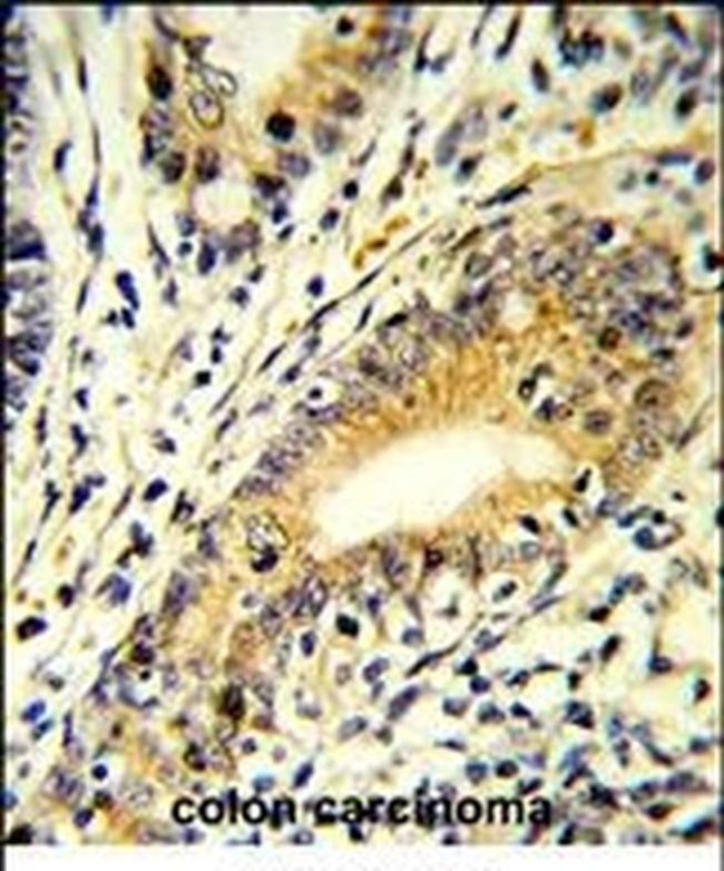 FAM3B Antibody in Immunohistochemistry (IHC)