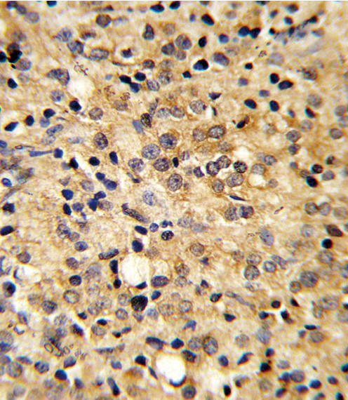 COMP Antibody in Immunohistochemistry (Paraffin) (IHC (P))