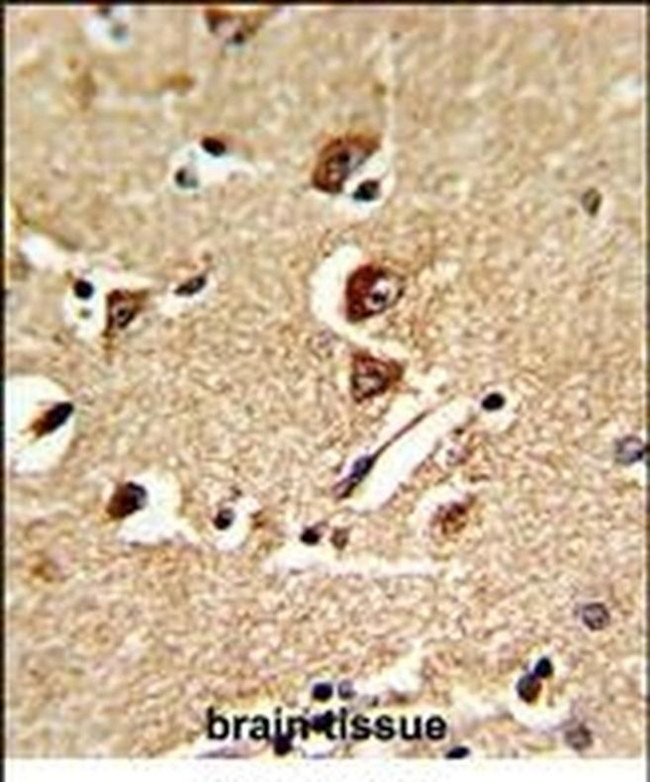 GNPAT Antibody in Immunohistochemistry (IHC)