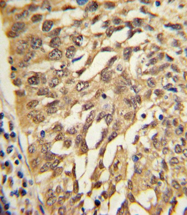 SAR1A Antibody in Immunohistochemistry (IHC)