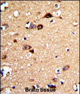 UNC5C Antibody in Immunohistochemistry (Paraffin) (IHC (P))