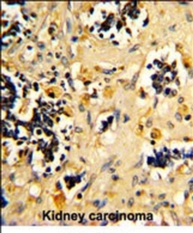 NDUFS4 Antibody in Immunohistochemistry (IHC)